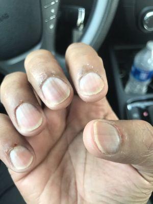 Can't file nails evenly or cut cuticles without cutting you.