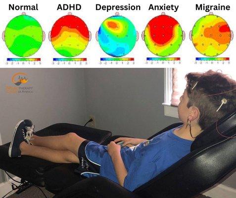 Neurofeedback Brain Training for ADHD