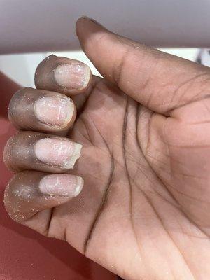 My nails after taking a set off