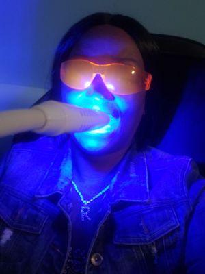 Teeth Whitening