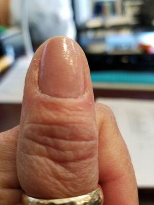 Does this look like a manicured nail?