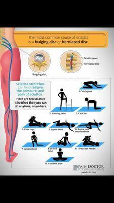 Stretches for Sciatic Nerve Pain