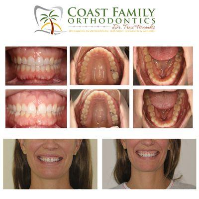 Traci R Fernandes, DDS - Coast Family Orthodontics