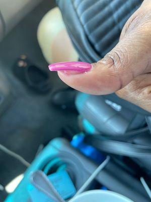 Why is her nail like this?