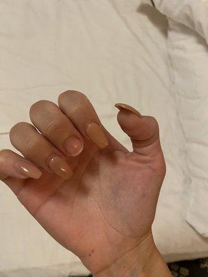 Nail fell off