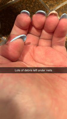 Lots of debris left under my nails