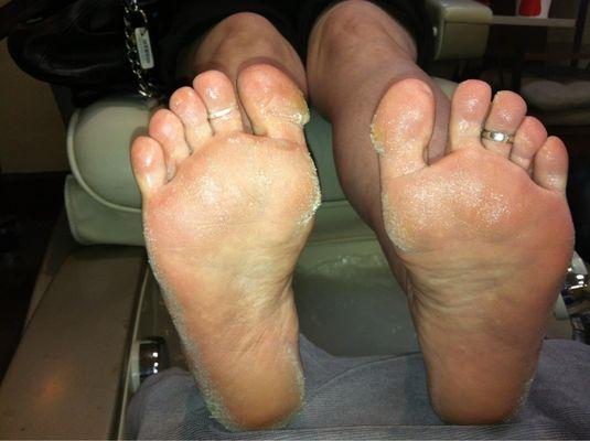 What the feet look like prior to the one hour pedicure treatment!