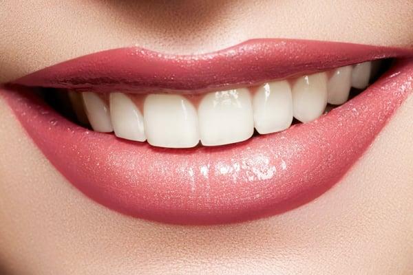 My teeth color after getting them whitened at Dr. Maginnis' office... Literally pearl white.