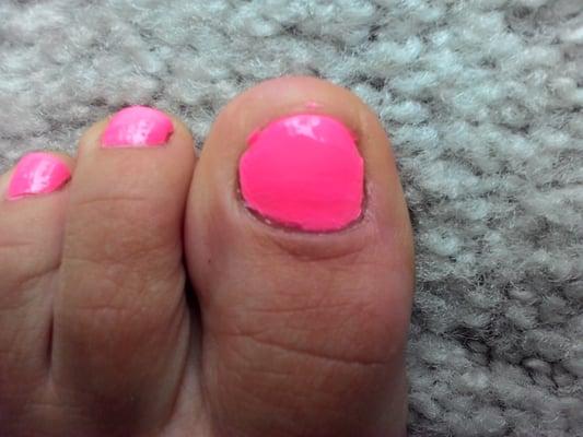 If you zoom in you'll still see a tiny bit of polish on the skin of my big toe. The cuticle is dry and rigid.