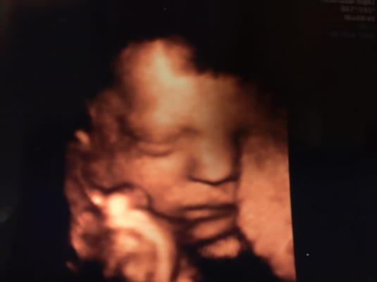 Our sweet baby boy at 32 weeks! Very thankful for Sweet Miracles for taking the time to get such an awesome shot!