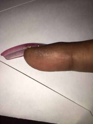 Fungus contracted at Nail Club from nail tech Lon