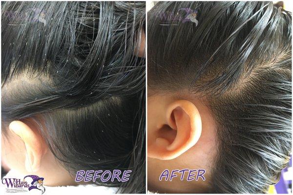 Before and After Treatment