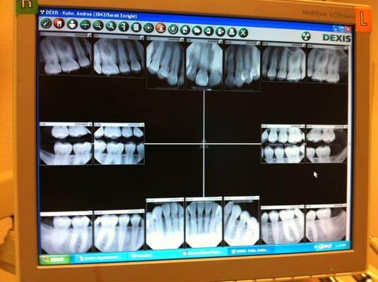 My teeth :)