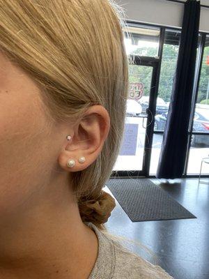 Tragus