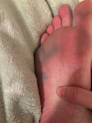 Blue tablet in the pedicure tub dyed the bottom of my foot. I didn't notice until I got home.