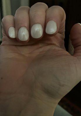 Clubbed looking fingernails