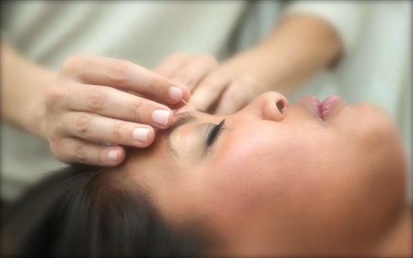 Acupuncture treatments leave you feeling relaxed and rejuvenated.