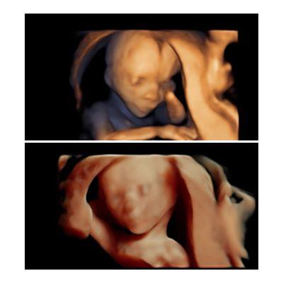 Little one in #3D & #highdefinition at 15 weeks. You can achieve images like this is long as you are #wellhydrated.