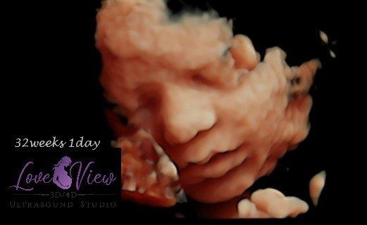 Love View 3d 4d ultrasound studio