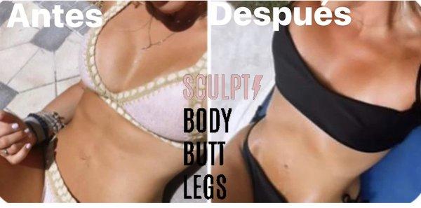 Real results Body Sculpting