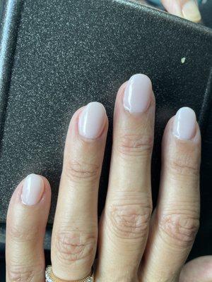 Nail fill