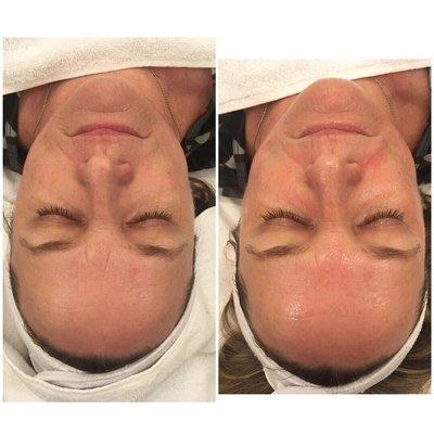 Facials By Brittany here at studio 841 I offer The Hydrafacial, Chemical Peels, Microdermabrasion, Facial massaged, waxing and more.