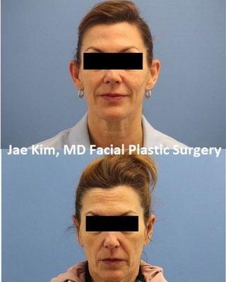 Jae Kim, MD Facial Plastic Surgery