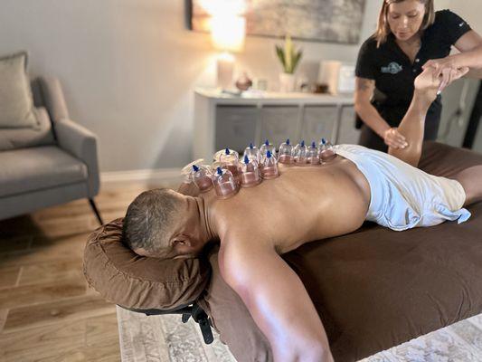 Sports massage treatment with cupping.