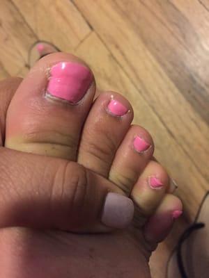 This is what my pedi looks like after 2 day!!!