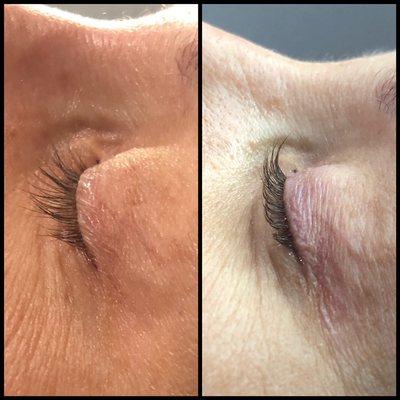 Side view of lashes before & after lash lift