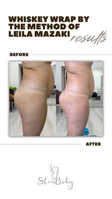 Whiskey Body Wrap: Before & After Results