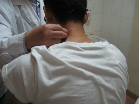 Neck pain treatment  by Dr. Lee, Shuguang Hospital, Shanghai China