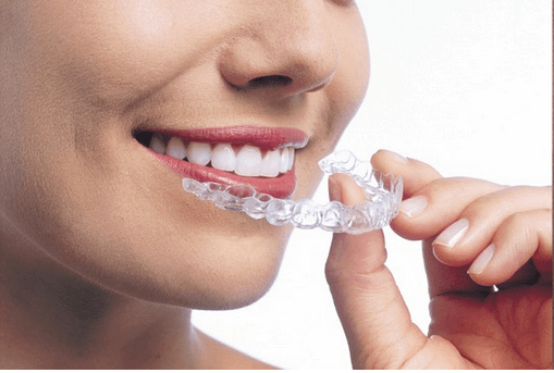 Invisalign