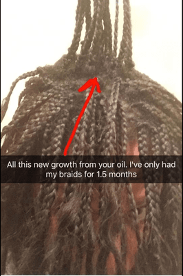 Hair Growth Oil after a month in a half.