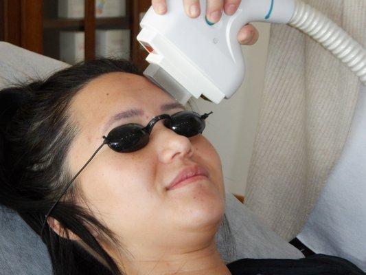 Laser Treatment