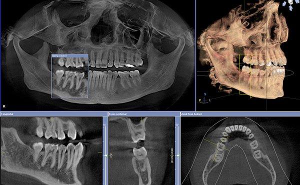 We now have the ability to preform 3D Xrays