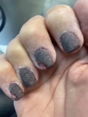 Horrible nails