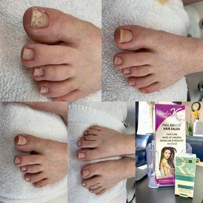 Before and after pedicure by Kianny