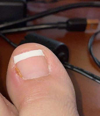 Got an infection after pedicure. Don't go there.