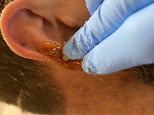 Ear sugaring