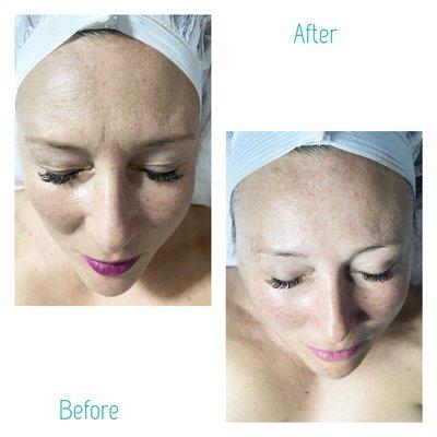 Relaxing facial & collagen eye treatment