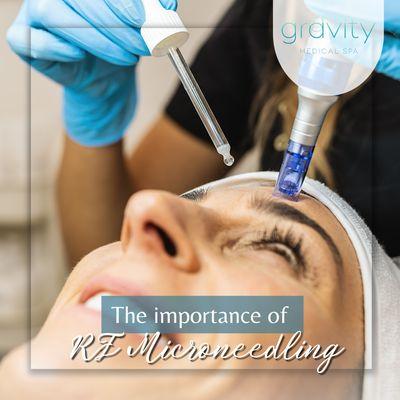 Clinical studies show that microneedling RF can address the causes of aging.
 Book your complimentary consultation today!