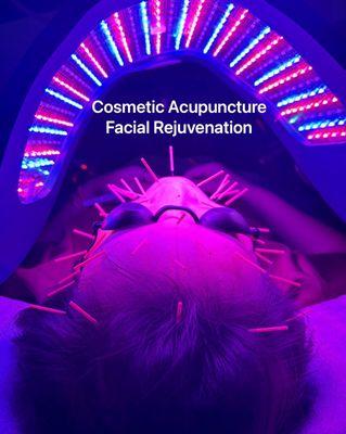 Facial Acupuncture