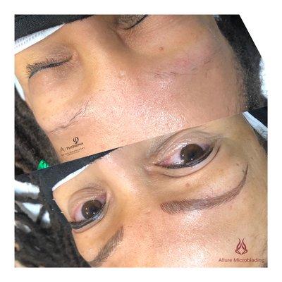 Microblading