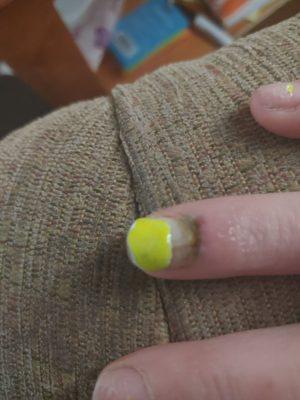 Improper application of an acrylic nail that lifted my real nail with it ..AND NO ONE CARED even after 2 hours in the chair