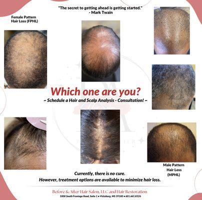 Experiencing Hair Thinning?