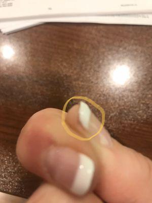 Other nail showing poor job of covering nail