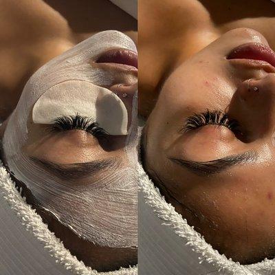 Facial before and after