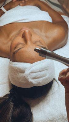 Diamond tip microdermabrasion treatment