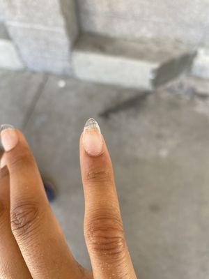 you can clearly see the nail is on crooked